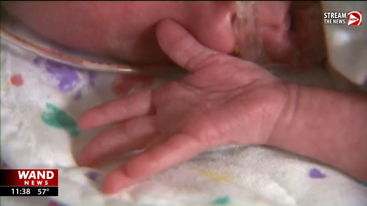 Illinois law could ensure families with NICU babies receive info on early intervention services